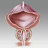Prostata